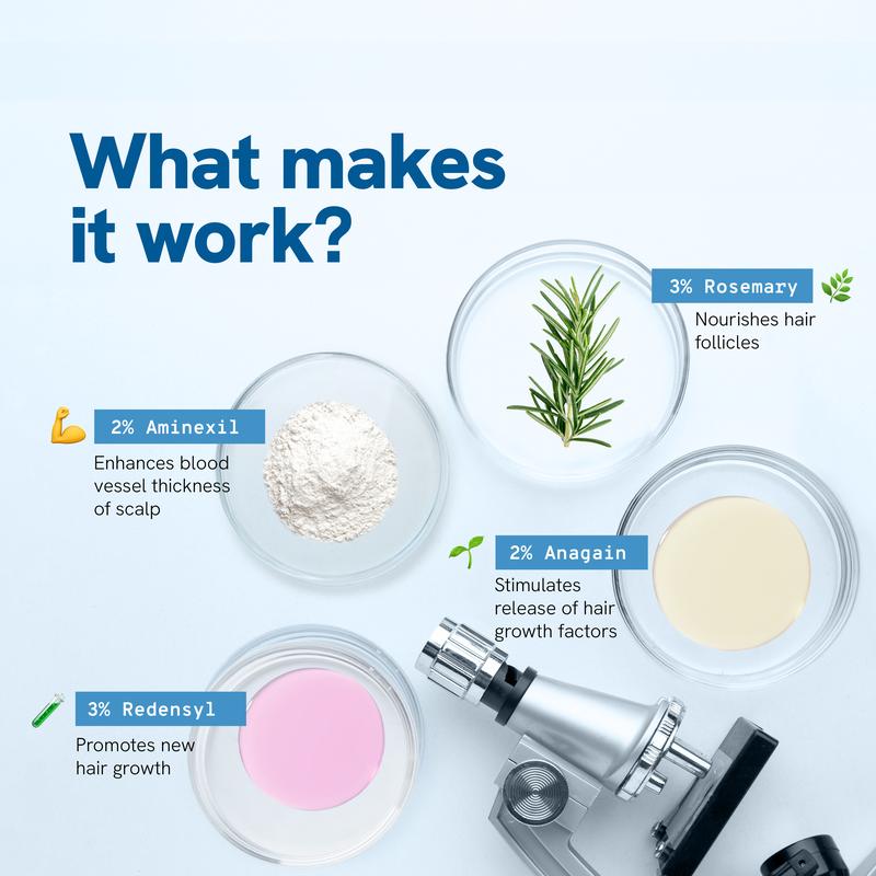 Precision Scalp Serum – Targeted Scalp Care with Rosemary & Aminexil