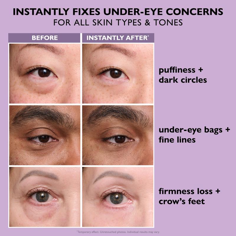 Wrinkle Eraser Eye Tightener – Instant Lift & All-Day Firmness
